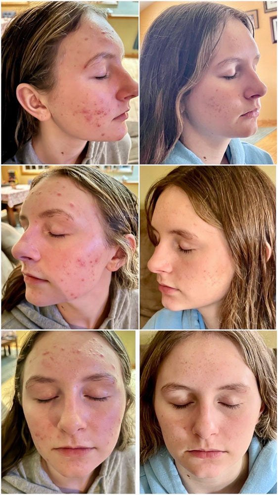 LumiGlow Pro Red Light Therapy - Skincare routine